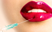 Lips Injection