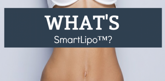 What's SmartLipo?