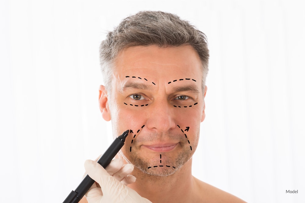 Man getting face mapped for facelift surgery.