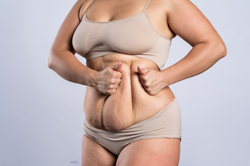 Woman in undergarments pushing together sagging skin in her midsection