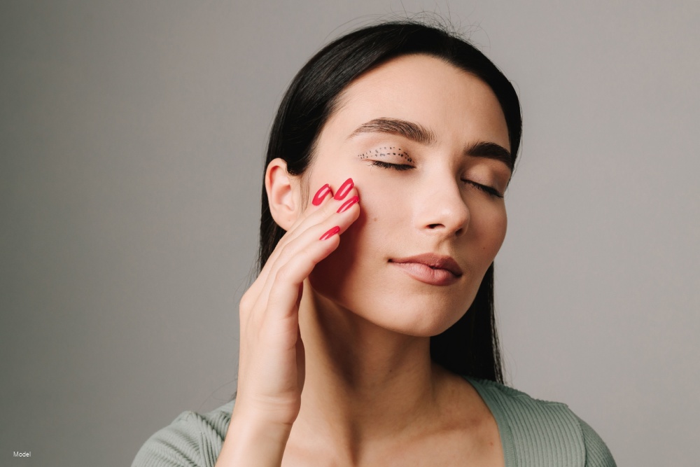 Blepharoplasty markup. Woman is showing well done contour for eye lids surgery.